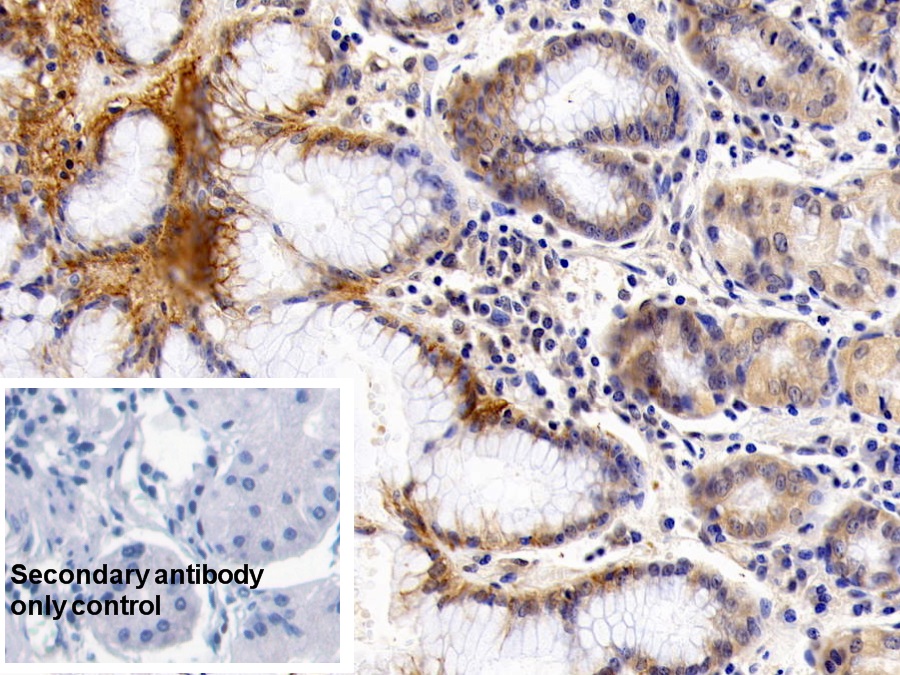 Monoclonal Antibody to Cluster Of Differentiation 147 (CD147)