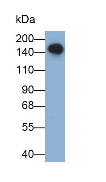 Monoclonal Antibody to Mannose Receptor C Type 1 (MRC1)