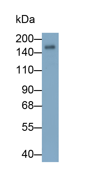 Monoclonal Antibody to Mannose Receptor C Type 1 (MRC1)