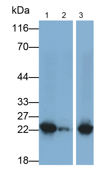 Monoclonal Antibody to Large Multifunctional Peptidase 7 (LMP7)