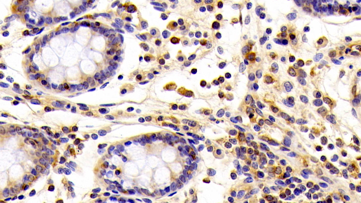 Monoclonal Antibody to Cofilin 1 (CFL1)