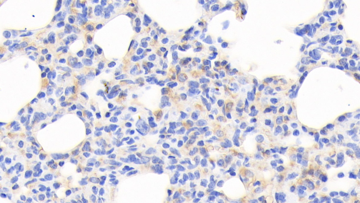 Monoclonal Antibody to Cofilin 1 (CFL1)