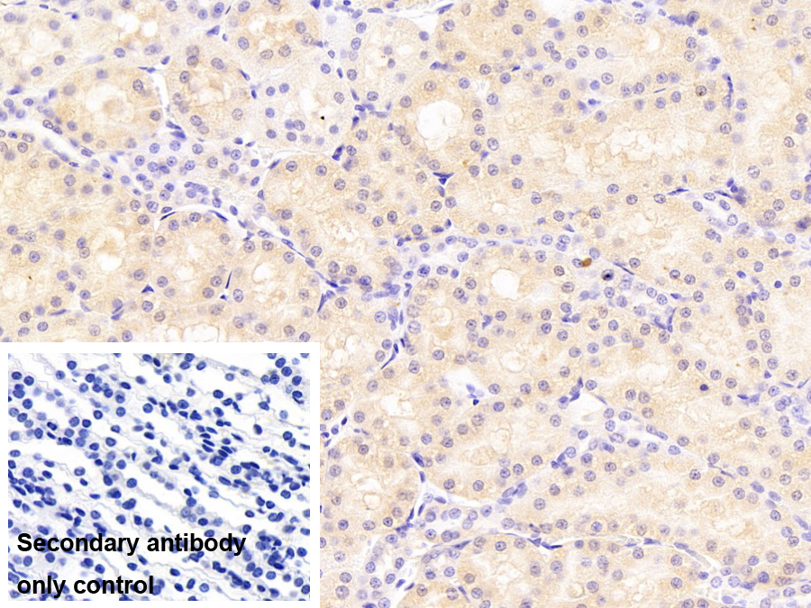 Monoclonal Antibody to Fatty Acid Binding Protein 1 (FABP1)