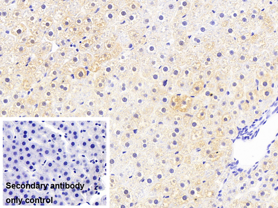Monoclonal Antibody to Fatty Acid Binding Protein 1 (FABP1)