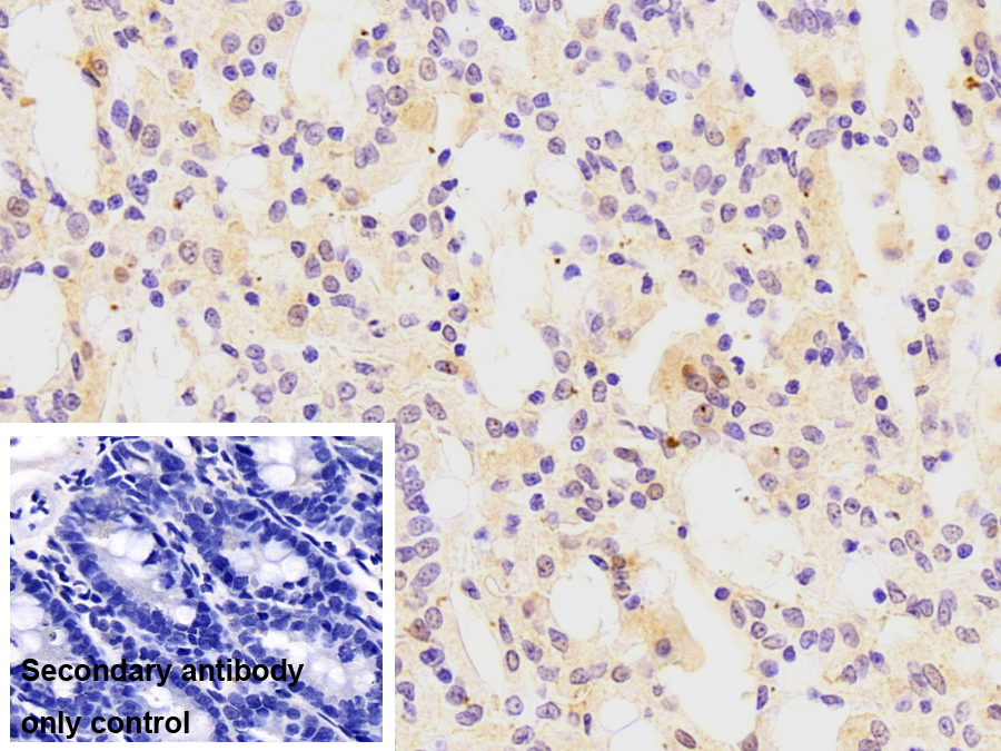Monoclonal Antibody to Fatty Acid Binding Protein 1 (FABP1)