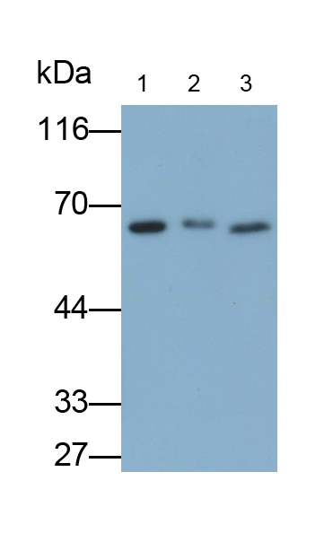 Monoclonal Antibody to Cluster Of Differentiation 64 (CD64)