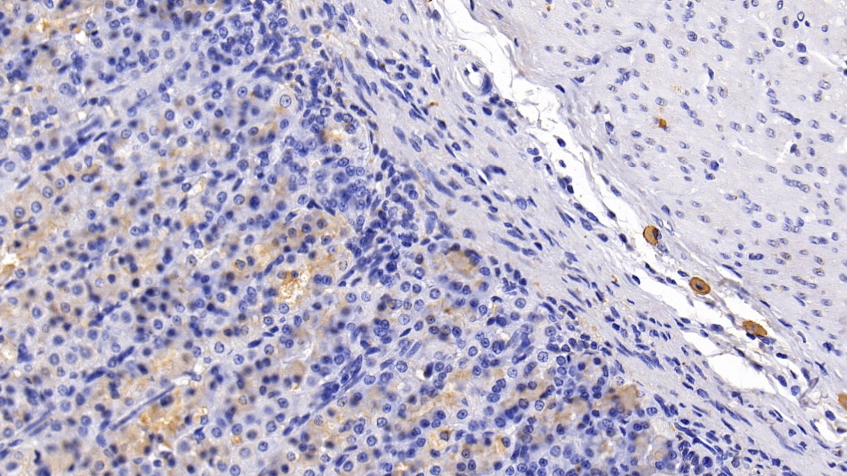 Monoclonal Antibody to Chemokine C-C-Motif Receptor 7 (CCR7)