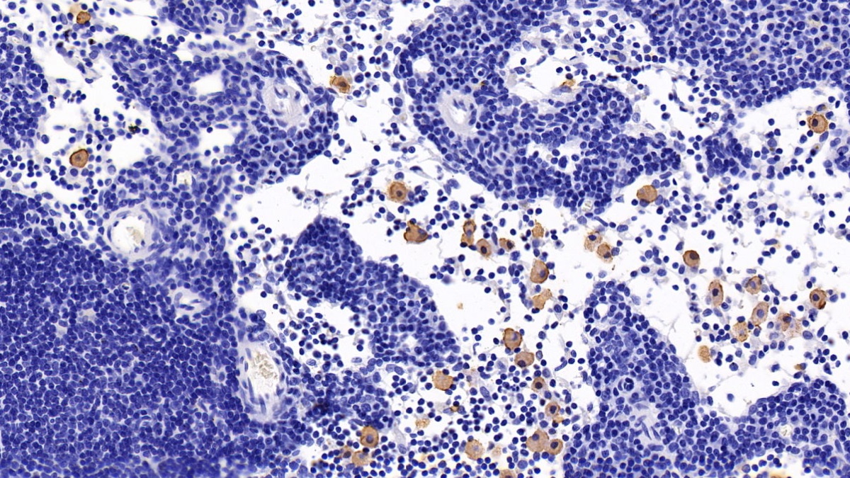 Monoclonal Antibody to Chemokine C-C-Motif Receptor 7 (CCR7)