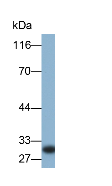 Monoclonal Antibody to Glucocorticoid Induced Tumor Necrosis Factor Receptor (GITR)