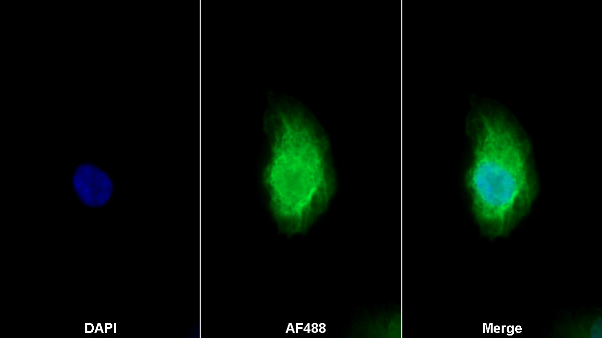 Monoclonal Antibody to B-Cell Activating Factor (BAFF)