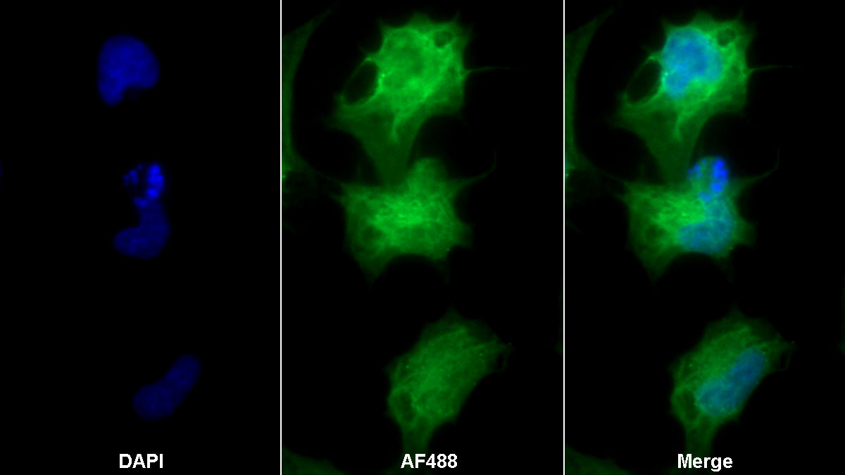 Monoclonal Antibody to B-Cell Activating Factor (BAFF)