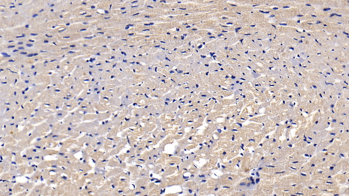 Monoclonal Antibody to Vascular Endothelial Growth Factor 165 (VEGF165)