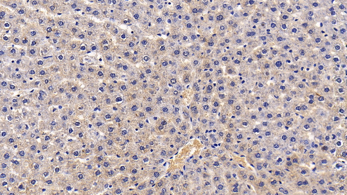 Monoclonal Antibody to Alpha-1-Antitrypsin (a1AT)