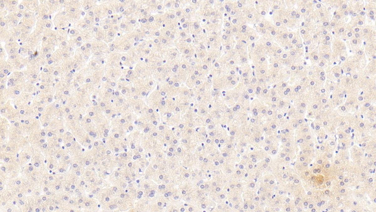 Monoclonal Antibody to Alpha-1-Antitrypsin (a1AT)