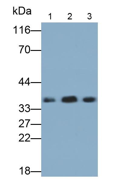Monoclonal Antibody to Lactate Dehydrogenase B (LDHB)