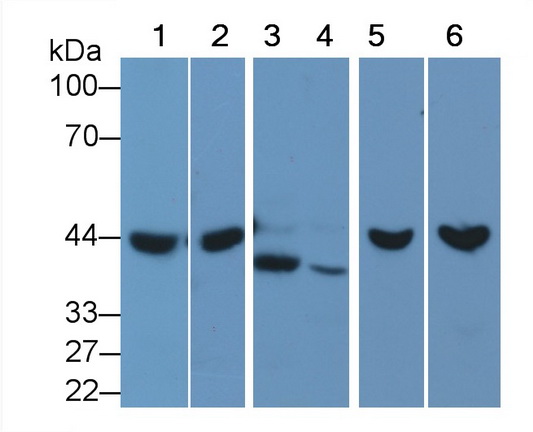 Monoclonal Antibody to TATA Binding Protein (TBP)