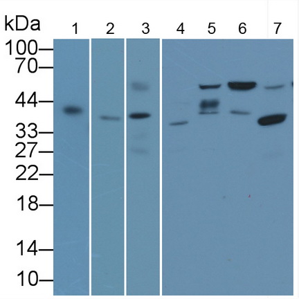 Monoclonal Antibody to TATA Binding Protein (TBP)