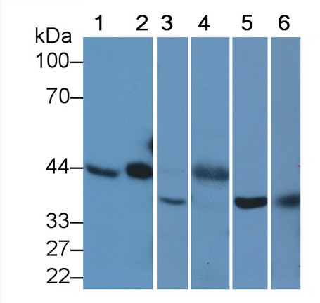 Monoclonal Antibody to TATA Binding Protein (TBP)