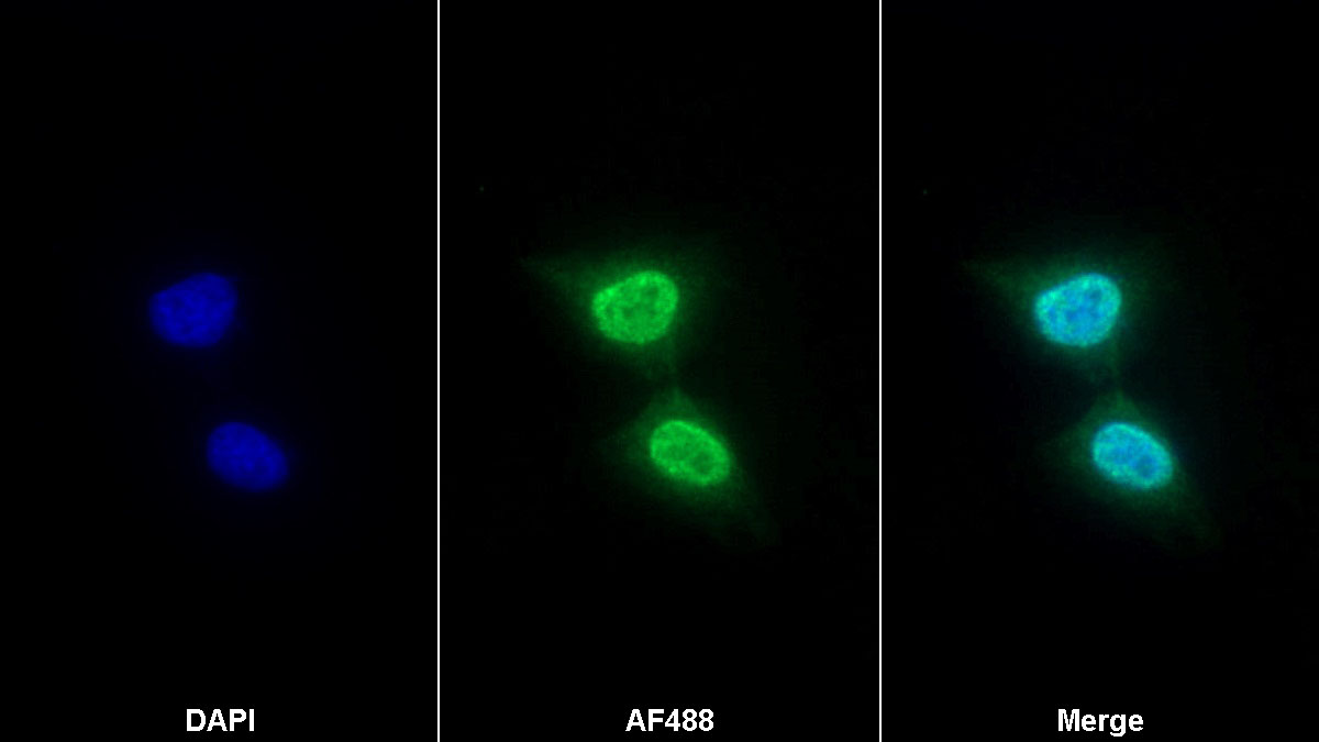 Monoclonal Antibody to TATA Binding Protein (TBP)