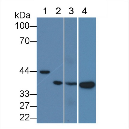Monoclonal Antibody to TATA Binding Protein (TBP)