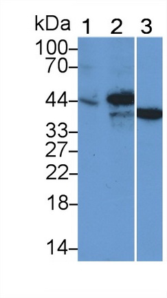 Monoclonal Antibody to TATA Binding Protein (TBP)