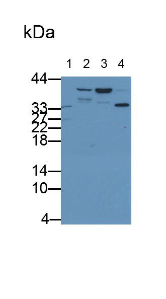 Monoclonal Antibody to TATA Binding Protein (TBP)