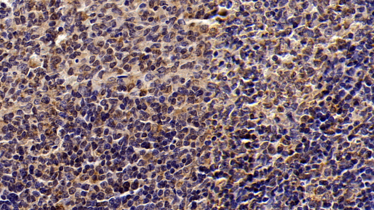 Monoclonal Antibody to Signal Transducer And Activator Of Transcription 3 (STAT3)