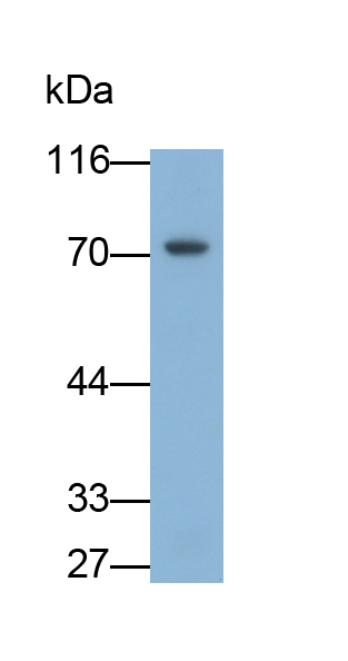 Monoclonal Antibody to Transglutaminase 3, Epidermal (TGM3)