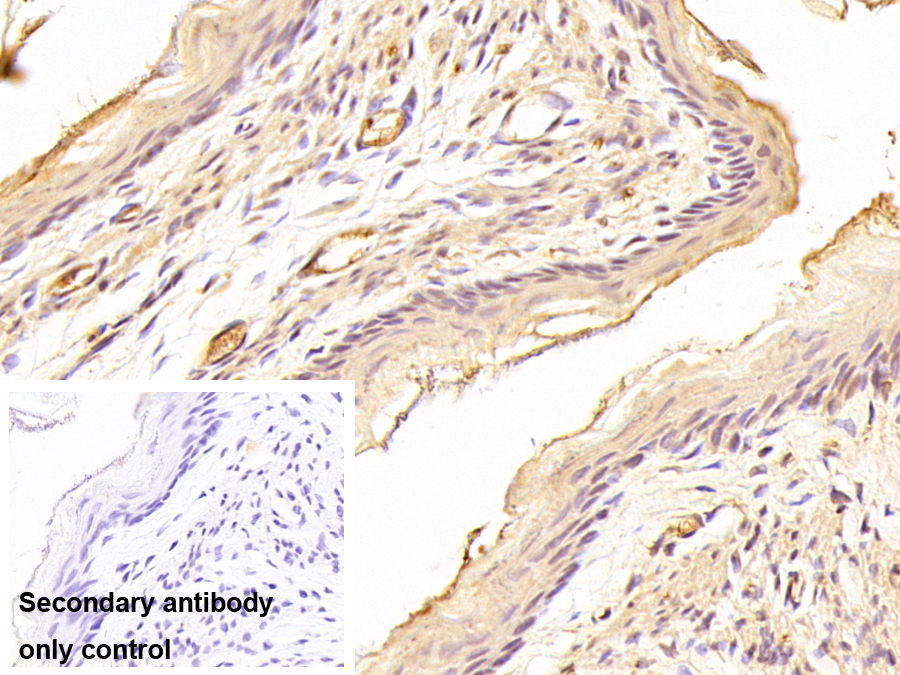 Monoclonal Antibody to Transglutaminase 3, Epidermal (TGM3)