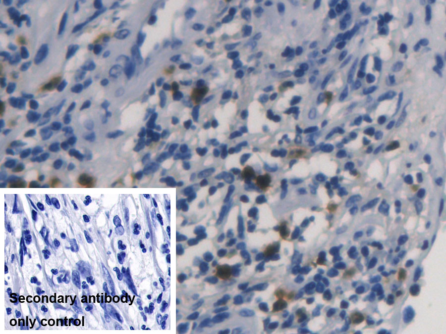 Monoclonal Antibody to Ribonuclease A3 (RNASE3)