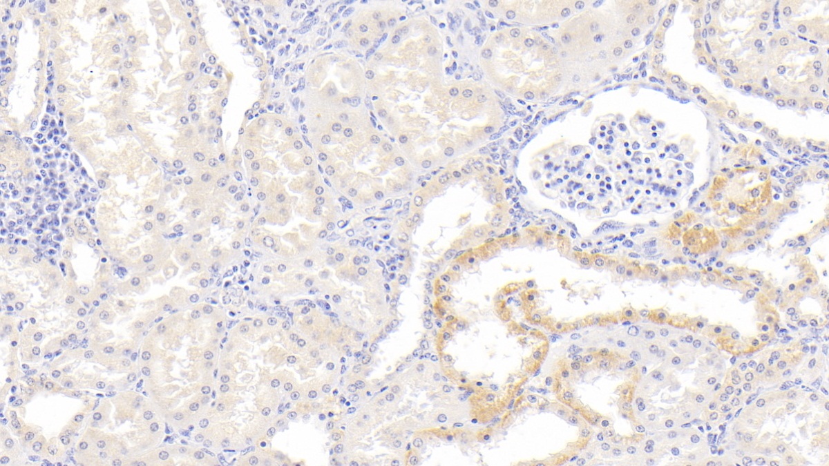 Monoclonal Antibody to Inhibin Beta B (INHbB)
