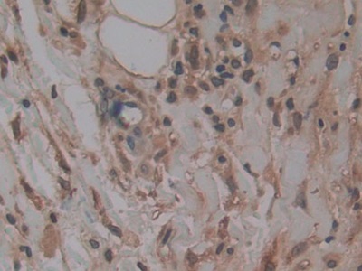 Monoclonal Antibody to S100 Calcium Binding Protein A6 (S100A6)
