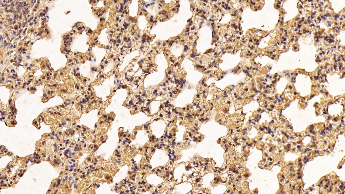 Monoclonal Antibody to S100 Calcium Binding Protein A6 (S100A6)