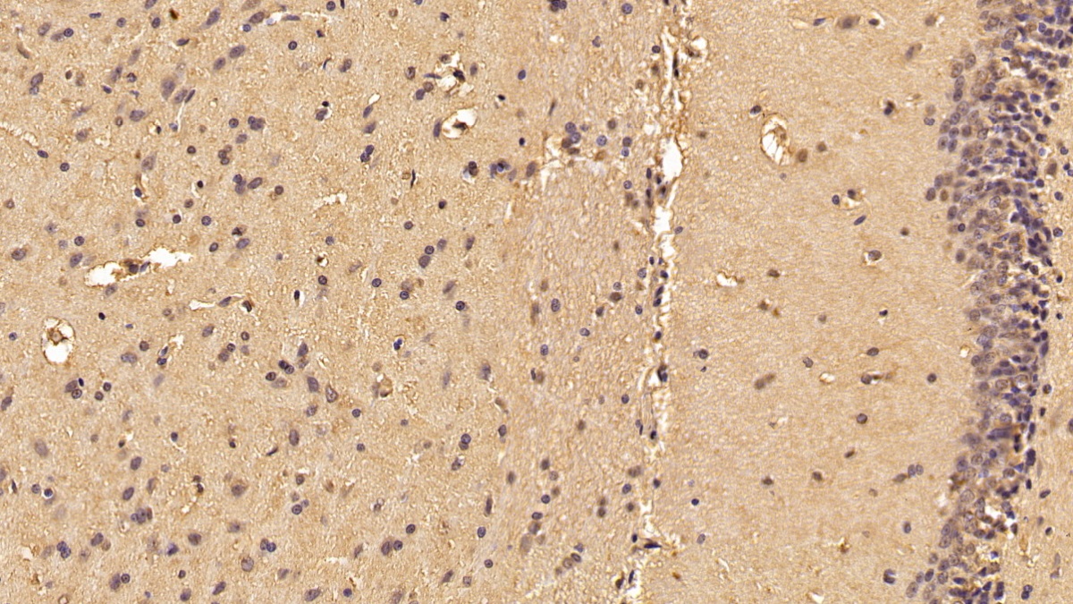 Monoclonal Antibody to S100 Calcium Binding Protein A6 (S100A6)