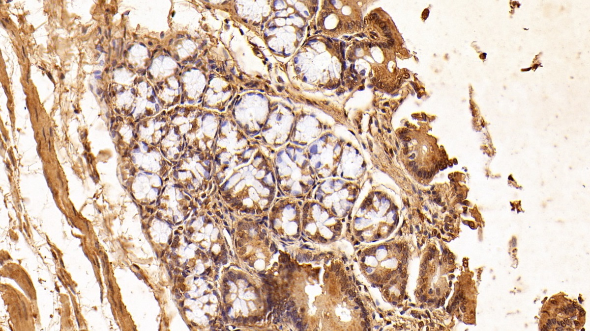 Monoclonal Antibody to S100 Calcium Binding Protein A6 (S100A6)