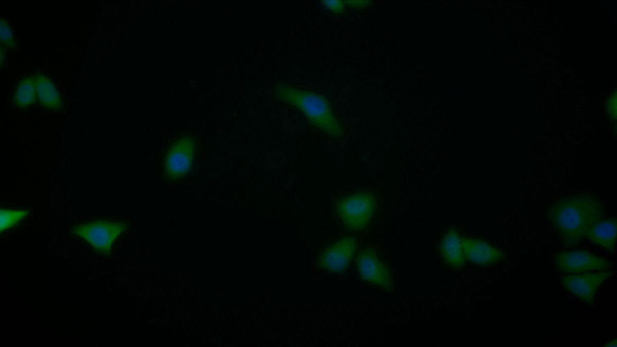 Monoclonal Antibody to S100 Calcium Binding Protein A6 (S100A6)