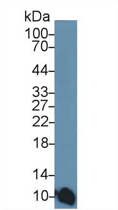 Monoclonal Antibody to S100 Calcium Binding Protein A6 (S100A6)