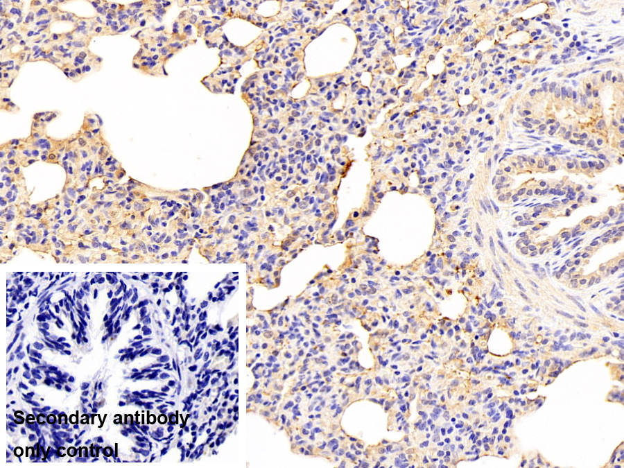 Monoclonal Antibody to Orosomucoid 2 (ORM2)