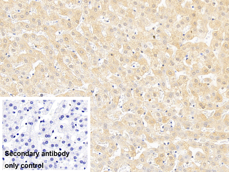 Monoclonal Antibody to Orosomucoid 2 (ORM2)