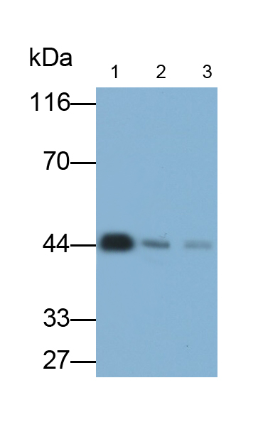 Monoclonal Antibody to Orosomucoid 2 (ORM2)