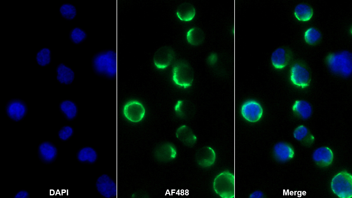 Monoclonal Antibody to Neprilysin (CD10)