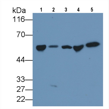 Monoclonal Antibody to Vitamin D Binding Protein (DBP)