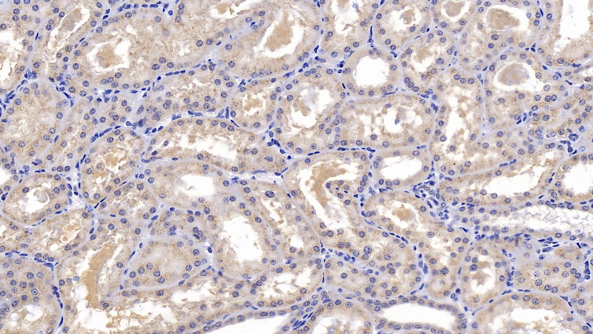 Monoclonal Antibody to Vitamin D Binding Protein (DBP)