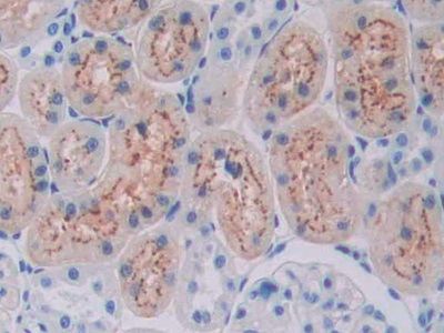 Monoclonal Antibody to Vitamin D Binding Protein (DBP)