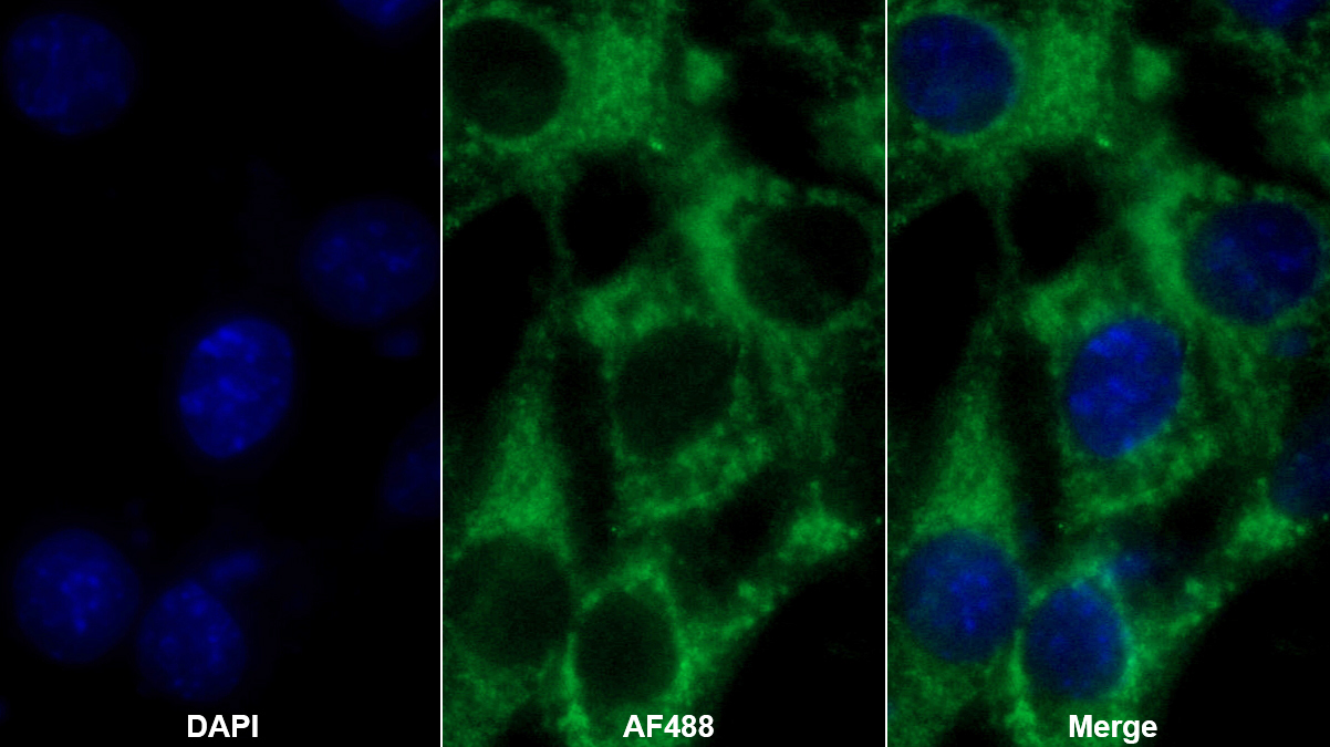 Monoclonal Antibody to Vitamin D Binding Protein (DBP)