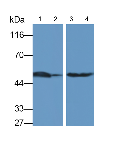 Monoclonal Antibody to Vitamin D Binding Protein (DBP)