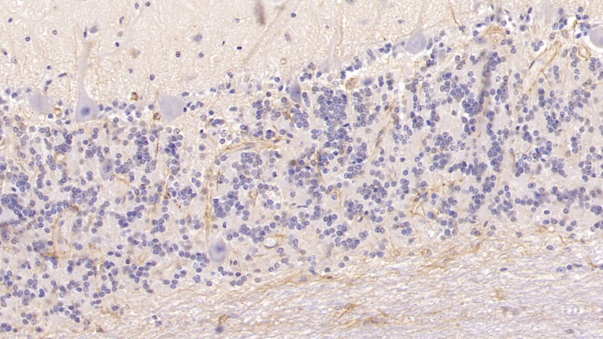 Monoclonal Antibody to Cytokeratin 17 (CK17)