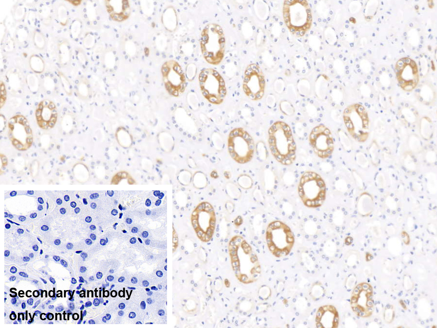 Monoclonal Antibody to Cytokeratin 17 (CK17)