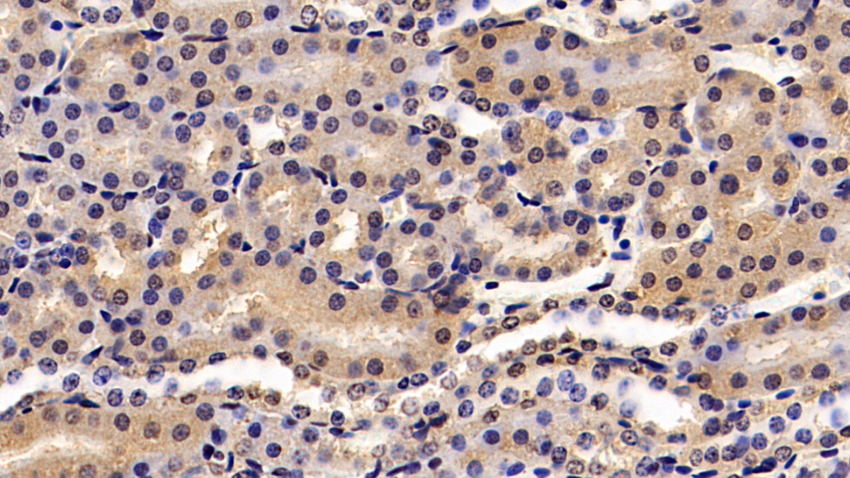 Monoclonal Antibody to Hedgehog Homolog, Sonic (SHH)