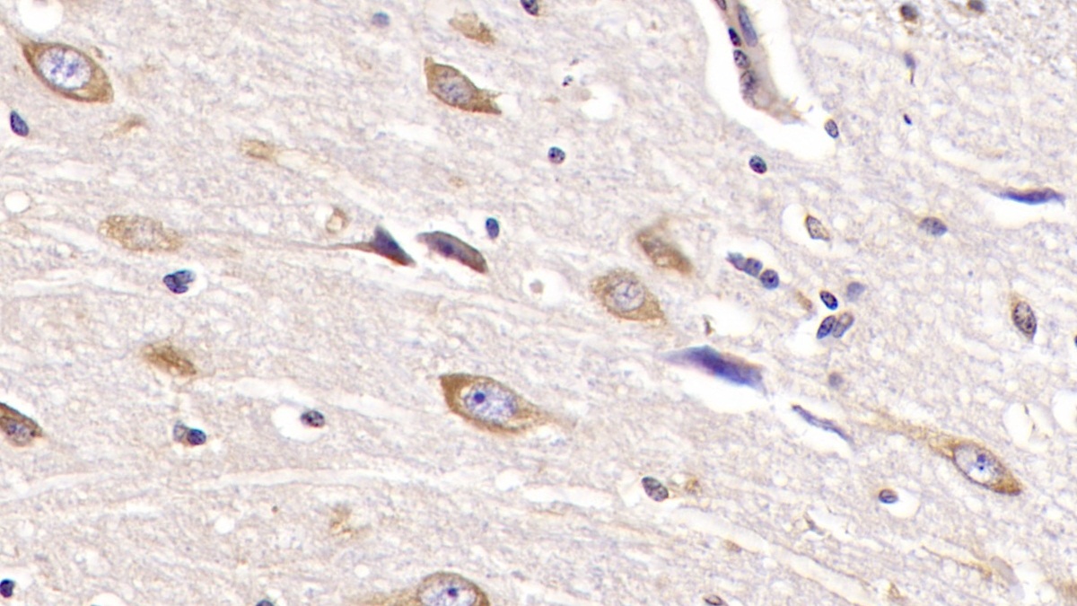 Monoclonal Antibody to Hedgehog Homolog, Sonic (SHH)